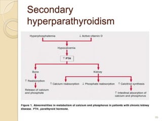 Secondary
hyperparathyroidism
89
 