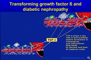 Transforming growth factor ß and
diabetic nephropathy
 