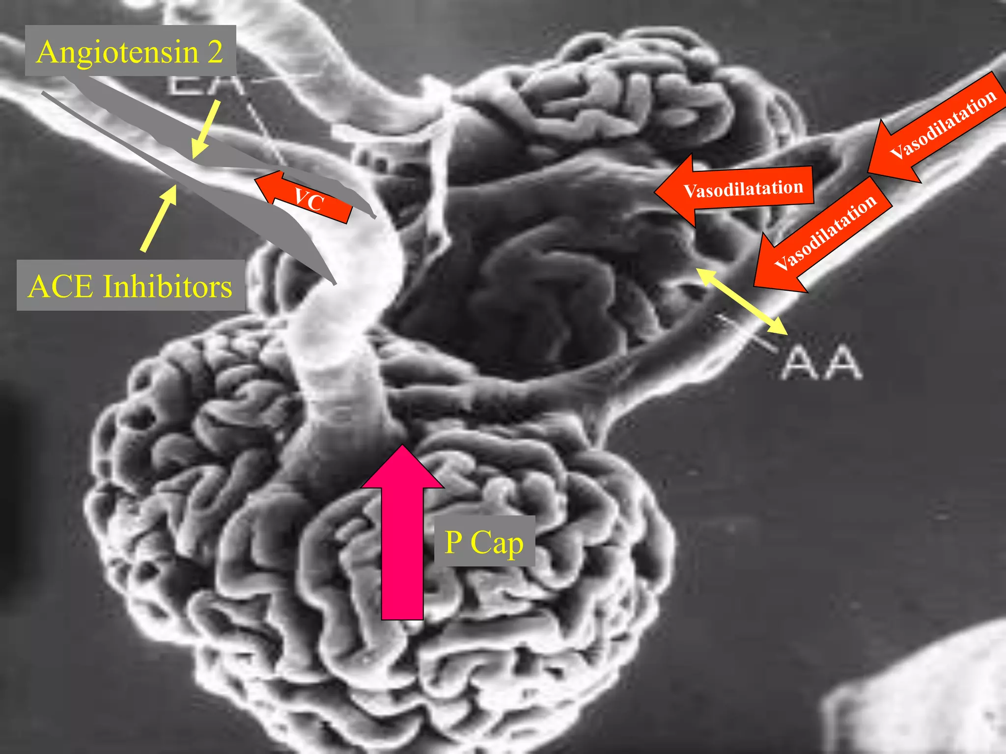 Angiotensin 2
P Cap
ACE Inhibitors
 