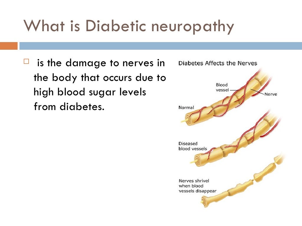 Diabetic neuropathy