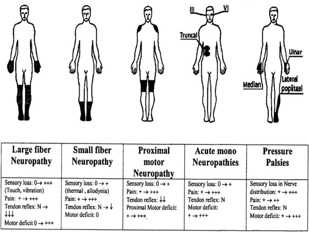 Diabetic neuropathy
