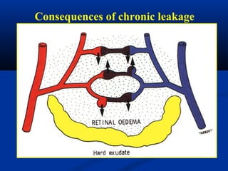 Consequences of chronic leakage
 