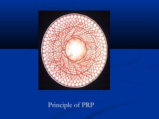 Principle of PRP
 