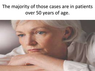 The majority of those cases are in patients
          over 50 years of age.
 