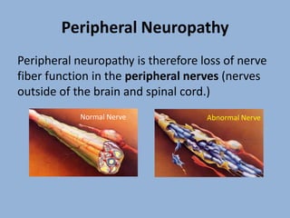 Peripheral Neuropathy
Peripheral neuropathy is therefore loss of nerve
fiber function in the peripheral nerves (nerves
outside of the brain and spinal cord.)
            Normal Nerve            Abnormal Nerve
 