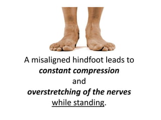 A misaligned hindfoot leads to
    constant compression
             and
 overstretching of the nerves
        while standing.
 