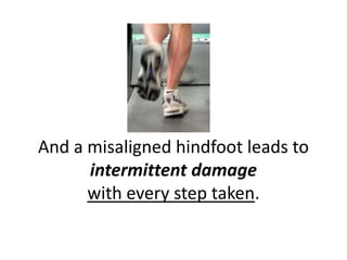 And a misaligned hindfoot leads to
      intermittent damage
      with every step taken.
 