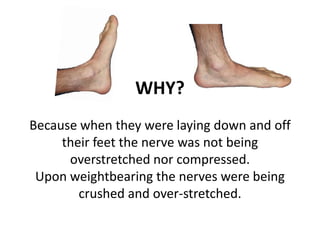 WHY?
Because when they were laying down and off
     their feet the nerve was not being
      overstretched nor compressed.
 Upon weightbearing the nerves were being
        crushed and over-stretched.
 