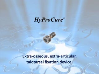 HyProCure        ®




Extra-osseous, extra-articular,
  talotarsal fixation device.
 