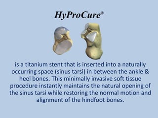 HyProCure         ®




  is a titanium stent that is inserted into a naturally
 occurring space (sinus tarsi) in between the ankle &
    heel bones. This minimally invasive soft tissue
procedure instantly maintains the natural opening of
the sinus tarsi while restoring the normal motion and
            alignment of the hindfoot bones.
 