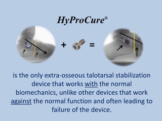 HyProCure        ®




                  +         =

 is the only extra-osseous talotarsal stabilization
        device that works with the normal
  biomechanics, unlike other devices that work
against the normal function and often leading to
               failure of the device.
 