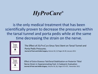 HyProCure                                ®




     is the only medical treatment that has been
scientifically proven to decrease the pressures within
 the tarsal tunnel and porta pedis while at the same
        time decreasing the strain on the nerve.
           The Effect of HyProCure Sinus Tarsi Stent on Tarsal Tunnel and
           Porta Pedis Pressures.
           Journal of Foot and Ankle Surgery, Volume 50, (1) Pages 44-49, January 2011




           Effect of Extra-Osseous TaloTarsal Stabilization on Posterior Tibial
           Nerve Strain in Hyperpronating Feet: A Cadaveric Evaluation
           Journal of Foot and Ankle Surgery, Volume 50, (6), Pages 672-675, November 2011
 