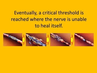 Eventually, a critical threshold is
reached where the nerve is unable
          to heal itself.
 