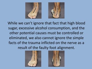 While we can’t ignore that fact that high blood
sugar, excessive alcohol consumption, and the
 other potential causes must be controlled or
 eliminated, we also cannot ignore the simple
facts of the trauma inflicted on the nerve as a
      result of the faulty foot alignment.
 