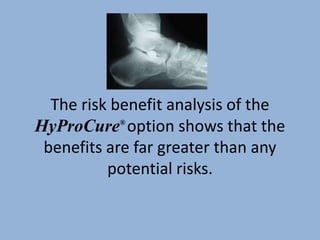 The risk benefit analysis of the
HyProCure® option shows that the
 benefits are far greater than any
          potential risks.
 
