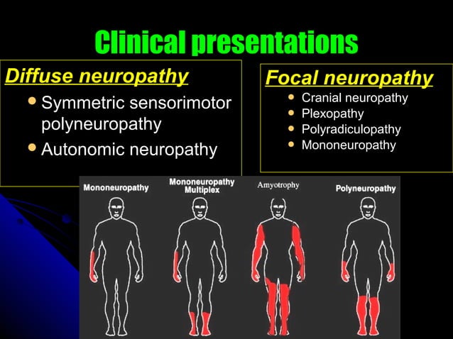 Diabetic POLYNEUROPATHY