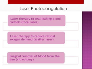 Laser Photocoagulation 
 