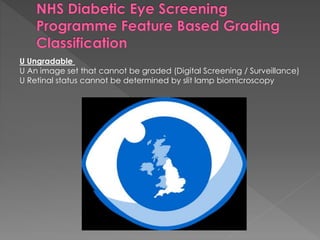 U Ungradable 
U An image set that cannot be graded (Digital Screening / Surveillance) 
U Retinal status cannot be determined by slit lamp biomicroscopy 
 