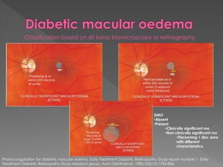 Classification based on slit lamp biomicroscopy or retinography 
DMO 
•Absent 
•Present 
•Clinically significant mo 
•Non clinically significant mo 
•Thickening 1 disc area 
with different 
characteristics. 
Photocoagulation for diabetic macular edema. Early Treatment Diabetic Retinopathy Study report number 1. Early 
Treatment Diabetic Retinopathy Study research group. Arch Ophthalmol. 1985;103(12):1796-806. 
 