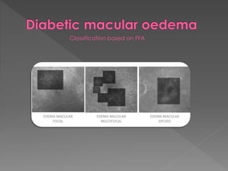 Classification based on FFA 
 