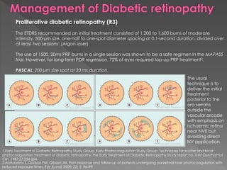Proliferative diabetic retinopathy (R3) 
The ETDRS recommended an initial treatment consisted of 1,200 to 1,600 burns of moderate 
intensity, 500-μm size, one-half to one-spot diameter spacing at 0.1-second duration, divided over 
at least two sessions1.(Argon laser) 
The use of 1500, 20ms PRP burns in a single session was shown to be a safe regimen in the MAPASS 
trial. However, for long-term PDR regression, 72% of eyes required top-up PRP treatment2. 
PASCAL: 200 μm size spot at 20 ms duration. 
The usual 
technique is to 
deliver the initial 
treatment 
posterior to the 
ora serrata 
outside the 
vascular arcade 
with emphasis on 
ischaemic retina 
near NVE but 
avoiding direct 
NV application. 
1.Early Treatment of Diabetic Retinopathy Study Group. Early Photocoagulation Study Group. Techniques for scatter and local 
photocoagulation treatment of diabetic retinopathy: the Early Treatment of Diabetic Retinopathy Study report no. 3 Int Ophthalmol 
Clin. 1987;27:254-264. 
2.Al-Hussainy S, Dodson PM, Gibson JM. Pain response and follow-up of patients undergoing panretinal laser photocoagulation with 
reduced exposure times. Eye (Lond) 2008; 22(1): 96–99 
 