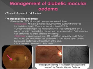 Control of systemic risk factors 
Photocoagulation treatment 
The modified ETDRS focal/grid was performed as follows: 
Focal laser: All leaking microaneurysms 500 to 3000μm from fovea 
treated directly with 50μm spot size, duration 0.05-0.1s. 
Direct whitenening of the micronaneurysm was not required, but a 
greyish reaction beneath the microaneurysm was needed. Grid treatment 
was performed to areas of retinal thickening. 
Grid laser was performed from 500 to 3000μm superiorly and inferiorly 
and to 3500μm temporally. The spots were 2 burn widths apart and no 
burns were performed within 500μm of the disc. 
Time between treatments: 3-4 months 
 