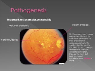 Increased microvascular permeability 
Macular oedema 
Hard exudates 
Haemorrhages 
Dot haemorrhages cannot 
always be differentiated 
from microaneurysms as 
they are similar in 
appearance but with 
varying size. Hence it is 
traditional not to attempt 
differentiate them on 
clinical examination. 
Instead the term dot 
haemorrhage/ 
microaneurysm (H/Ma) is 
used. 
 
