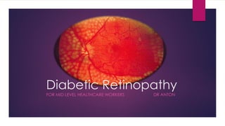 Diabetic Retinopathy
FOR MID LEVEL HEALTHCARE WORKERS DR ANTON
 