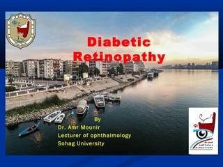 Diabetic
Retinopathy
By
Dr. Amr Mounir
Lecturer of ophthalmology
Sohag University
 