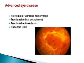 Diabetic retinopathy | PPTX