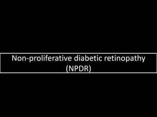 Non-proliferative diabetic retinopathy
(NPDR)
 