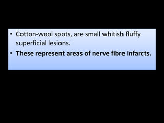 • Cotton-wool spots, are small whitish fluffy
superficial lesions.
• These represent areas of nerve fibre infarcts.
 