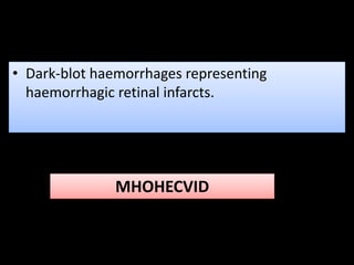 • Dark-blot haemorrhages representing
haemorrhagic retinal infarcts.
MHOHECVID
 