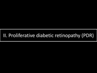 II. Proliferative diabetic retinopathy (PDR)
 