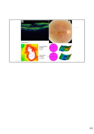 02-07-2020 Dept. of Ophthalmology, JNMC 119
119
 