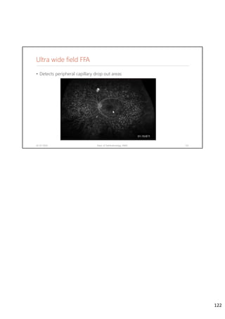 Ultra wide field FFA
• Detects peripheral capillary drop out areas
02-07-2020 Dept. of Ophthalmology, JNMC 122
122
 