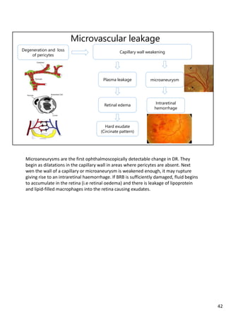 Microvascular leakage
Degeneration and loss
of pericytes
Capillary wall weakening
microaneurysm
Intraretinal
hemorrhage
Plasma leakage
Retinal edema
Hard exudate
(Circinate pattern)
Microaneurysms are the first ophthalmoscopically detectable change in DR. They 
begin as dilatations in the capillary wall in areas where pericytes are absent. Next 
wen the wall of a capillary or microaneurysm is weakened enough, it may rupture 
giving rise to an intraretinal haemorrhage. If BRB is sufficiently damaged, fluid begins 
to accumulate in the retina (i.e retinal oedema) and there is leakage of lipoprotein 
and lipid‐filled macrophages into the retina causing exudates.
42
 