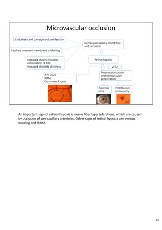 Microvascular occlusion
Endothelial cell damage and proliferation
Capillary basement membrane thickening
Increased plasma viscosity
Deformation of RBC
Increased platelets stickiness
Proliferative
retinopathy
Decreased capillary blood flow
and perfusion
A-V shunt
IRMA
Cotton wool spots
Retinal hypoxia
Neovascularization
and fibrovascular
proliferation
Rubeosis
iridis
VEGF
An important sign of retinal hypoxia is nerve fiber layer infarctions, which are caused 
by occlusion of pre‐capillary arterioles. Other signs of retinal hypoxia are venous 
beading and IRMA.
43
 