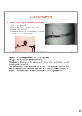 • They are the 1st sign of Diabetic Retinopathy
• How are they formed?
• Loss of pericytes of capillaries due to DM
• Capillary wall weakness
• Weakened wall bulges out or dilates in a saccular
manner to form microaneurysm
02-07-2020 Dept. of Ophthalmology, JNMC 54
1. Microaneurysms
There is one pericyte per endothelial cell in capillaries. 
They give structural support to the capillaries
They begin as dilatations in the capillary wall in areas where pericytes are absent, 
initially being thin walled.
Seen ophthalmoscopically when size is > 30 micron , better seen on red free filter
Microaneurysms – histopathology. Two arms of a capillary loop that may fuse to 
become a microaneurysm – flat preparation of Indian ink‐injected retina
54
 