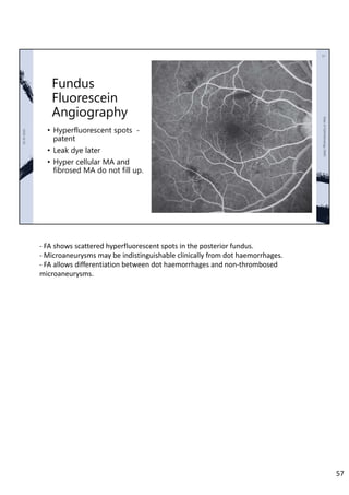 Fundus
Fluorescein
Angiography
• Hyperfluorescent spots -
patent
• Leak dye later
• Hyper cellular MA and
fibrosed MA do not fill up.
‐ FA shows scattered hyperfluorescent spots in the posterior fundus.
‐ Microaneurysms may be indistinguishable clinically from dot haemorrhages.
‐ FA allows differentiation between dot haemorrhages and non‐thrombosed
microaneurysms.
57
 