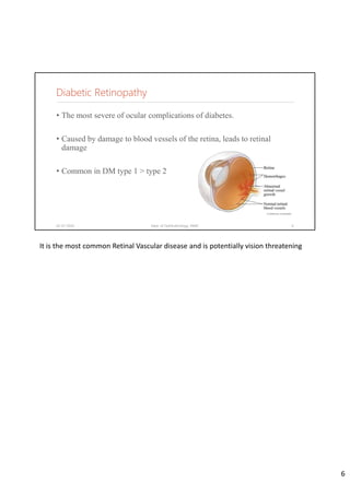 • The most severe of ocular complications of diabetes.
• Caused by damage to blood vessels of the retina, leads to retinal
damage
• Common in DM type 1 > type 2
02-07-2020 Dept. of Ophthalmology, JNMC 6
Diabetic Retinopathy
It is the most common Retinal Vascular disease and is potentially vision threatening
6
 