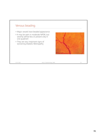 Venous beading
02-07-2020 Dept. of Ophthalmology, JNMC 78
• Major vessels have beaded appearance
• It may be seen in moderate NPDR, but
severity will be less or present only in
one quadrant
• They are very important signs of
worsening Diabetic Retinopathy
78
 