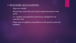 Diabetic retinopathy and Hallmark studies | PPTX