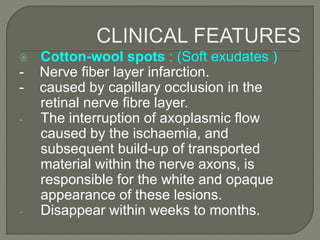 Cotton-wool spots : (Soft exudates )
- Nerve fiber layer infarction.
- caused by capillary occlusion in the
retinal nerve fibre layer.
- The interruption of axoplasmic flow
caused by the ischaemia, and
subsequent build-up of transported
material within the nerve axons, is
responsible for the white and opaque
appearance of these lesions.
- Disappear within weeks to months.
 
