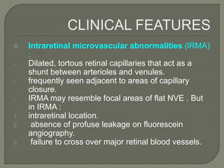  Intraretinal microvascular abnormalities (lRMA)
:
- Dilated, tortous retinal capillaries that act as a
shunt between arterioles and venules.
- frequently seen adjacent to areas of capillary
closure.
- IRMA may resemble focal areas of flat NVE . But
in IRMA :
1. intraretinal location.
2. absence of profuse leakage on fluorescein
angiography.
3. failure to cross over major retinal blood vessels.
 