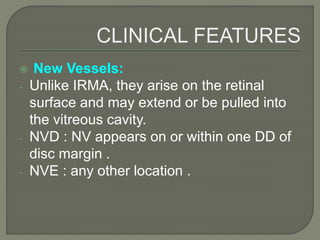  New Vessels:
- Unlike IRMA, they arise on the retinal
surface and may extend or be pulled into
the vitreous cavity.
- NVD : NV appears on or within one DD of
disc margin .
- NVE : any other location .
 