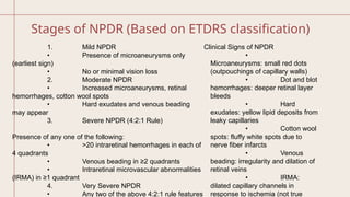 Diabetic Retinopathy.................... | PPTX