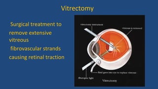 Vitrectomy
Surgical treatment to
remove extensive
vitreous
fibrovascular strands
causing retinal traction
 
