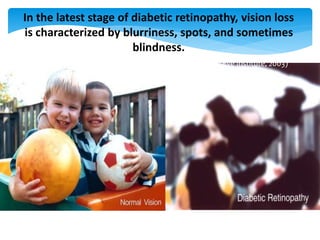 In the latest stage of diabetic retinopathy, vision loss
is characterized by blurriness, spots, and sometimes
blindness.
(National Eye Institute, 2003)
 