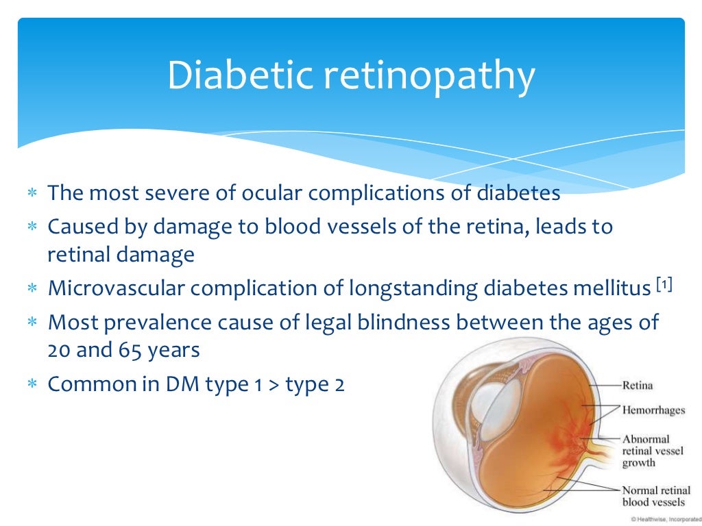Diabetic retinopathy 3032011